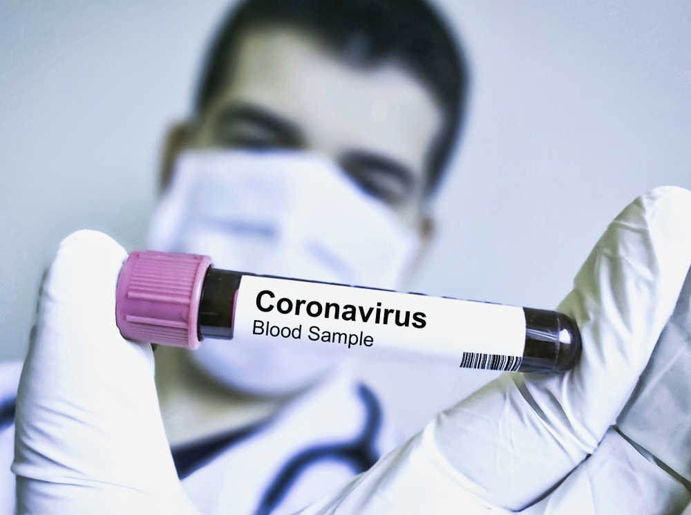Mainzer Unternehmen Optimistisch Entwickelter Corona Impfstoff Gegen Coronavirus Nahezu Perfekt